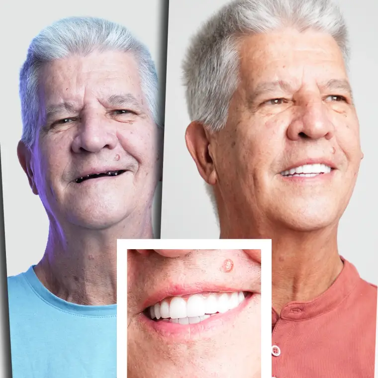 Dominique B. - Transformare Completă Zâmbet