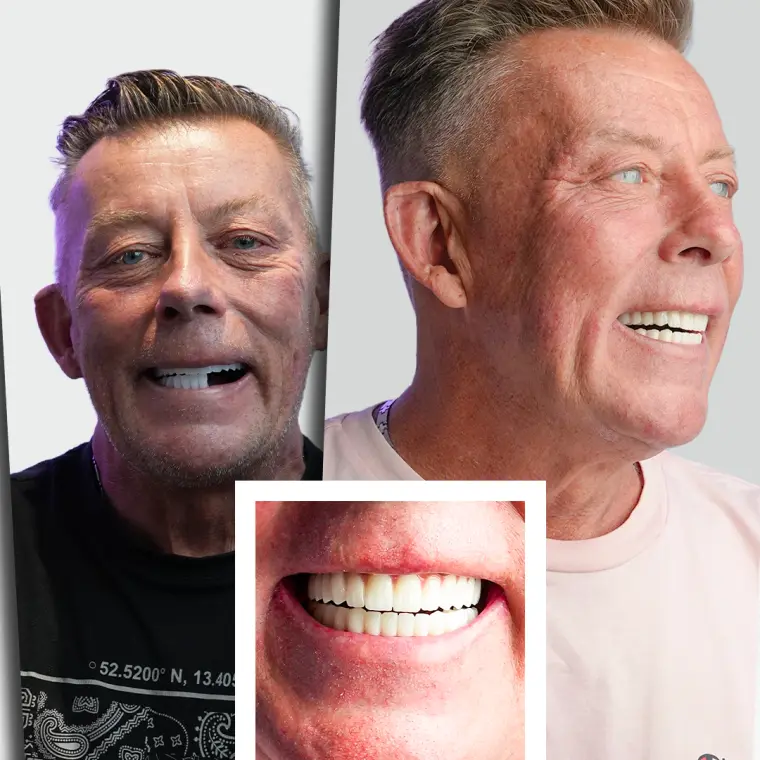 Jean Pascal L. - Fațete