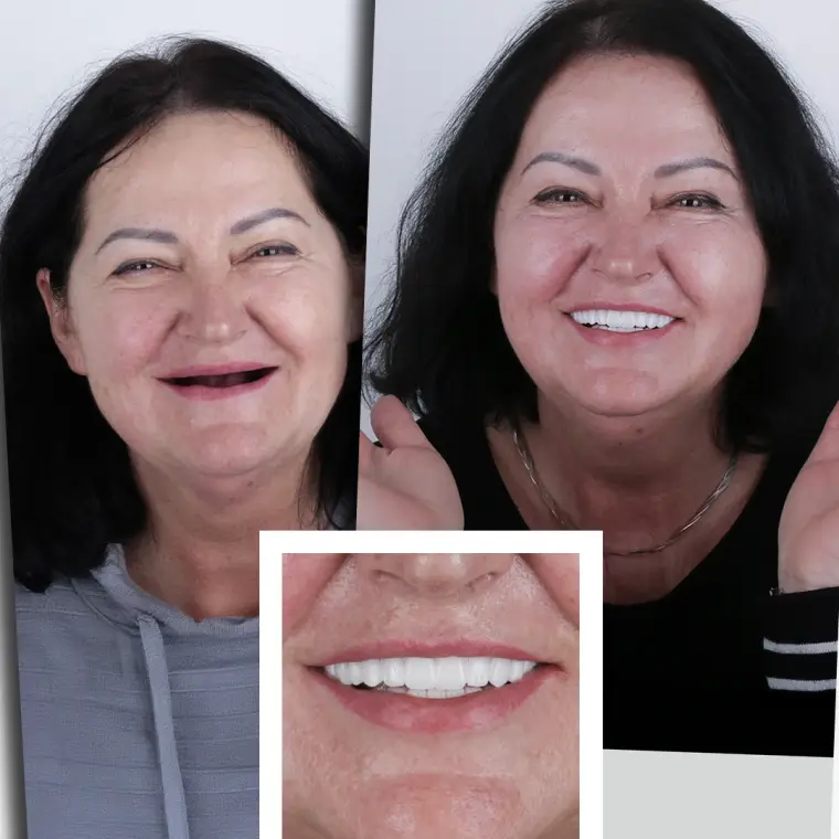 Larysa K. - Restaurare Completă